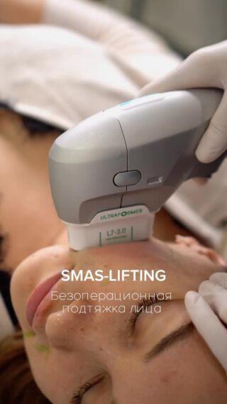 СТРОЙНОЕ И ПОДТЯНУТОЕ ЛИЦО!

Процедура SMAS-ЛИФТИНГ на аппарате ULTRAFORMER
С помощью направленного ультразвука уменьшает жировые клетки в проблемных зонах и запускает выработку нового коллагена, помогает избавиться от второго подбородка, брылей, носогубных складок и сделать лицо худее.

#косметологиямосква #клиникапавелецкая #ультраформермосква #красивыйоваллица